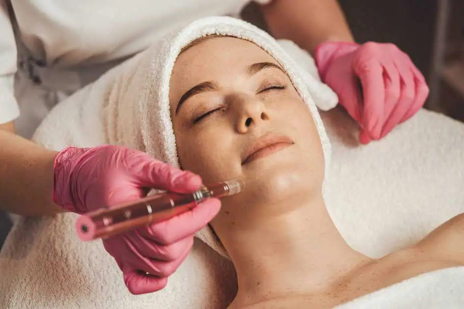 Nanoneedling in Warren, OH & Boardman, OH by Ageless Laser & Skin Medspa